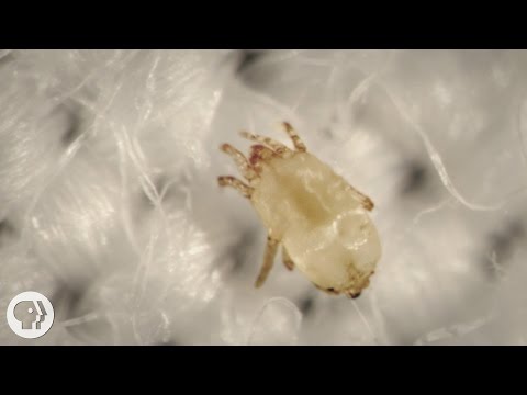 Meet the Dust Mites, Tiny Roommates That Feast On Your Skin  |  Deep Look