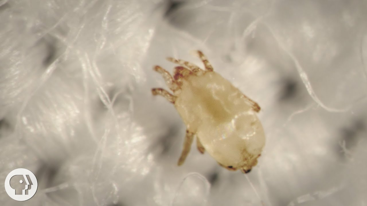Meet the Dust Mites, Tiny Roommates That Feast On Your Skin | Deep Look -  YouTube