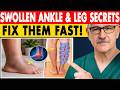 Edema: Swollen Feet, Swollen Ankles &amp; Swollen Legs [FIX Them FAST!] | Senior Health