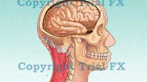 Traumatic Concussive Brain Injury