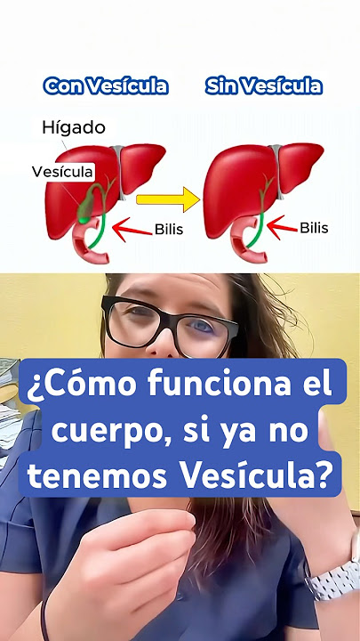 El cuerpo sin #vesícula 👩🏼‍⚕️#doctora #saluddigestiva #higado #bilis