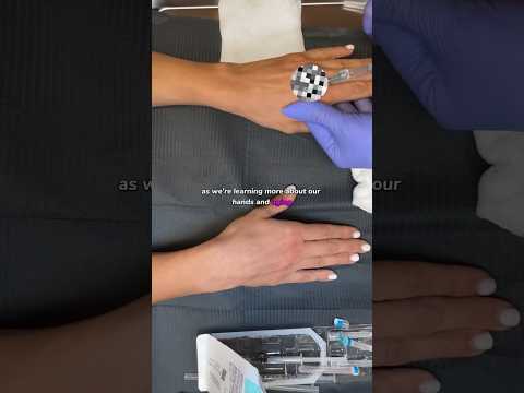 HandFix: Filler