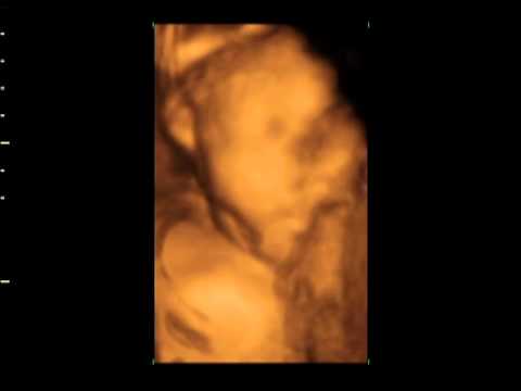 Baby boy Sayyid (4d ultrasound @ 29 weeks)