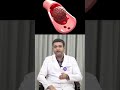 கழுத்து சொடக்கு எடுத்தால் பக்கவாதம் (Stroke) வருமா? அதிர்ச்சி தரும் மருத்துவ உண்மை! | SIMS Hospital