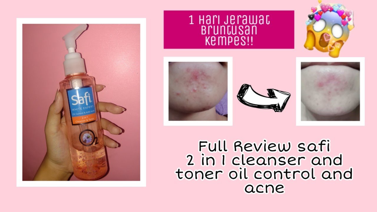safi toner acne solution