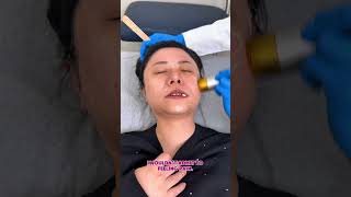 Inspira Derm’s Non-Invasive Treatment Experience (Patient Approved) #noninvasivetreatment