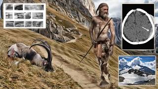 Ötzi the Iceman Mystery Solved - With Proof