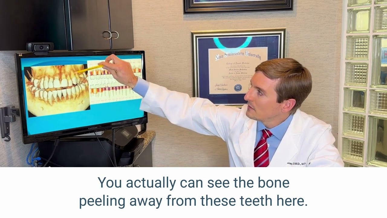 Does Smoking Cannabis Affect My Gums?