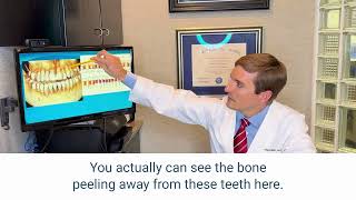 Does Smoking Cannabis Affect My Gums?
