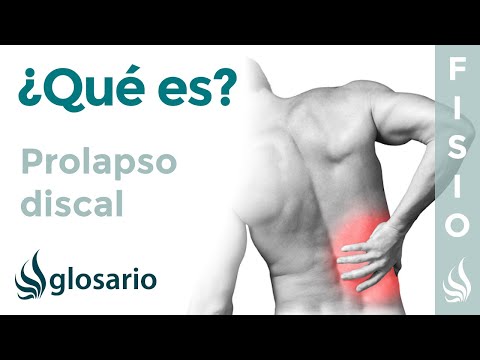 Vídeo: Prolapso De Disco: Causas, Síntomas Y Tratamiento