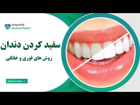 تصویری: 10 روش برای سفید کردن دندان ها