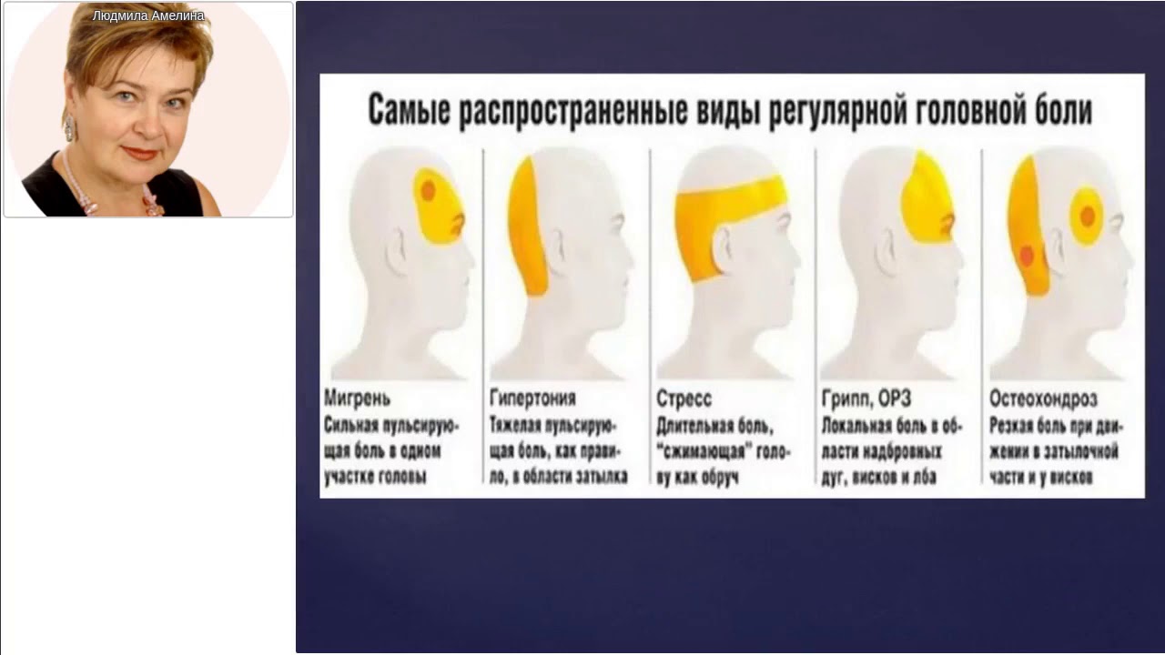 Эраконд активен против любой головной боли