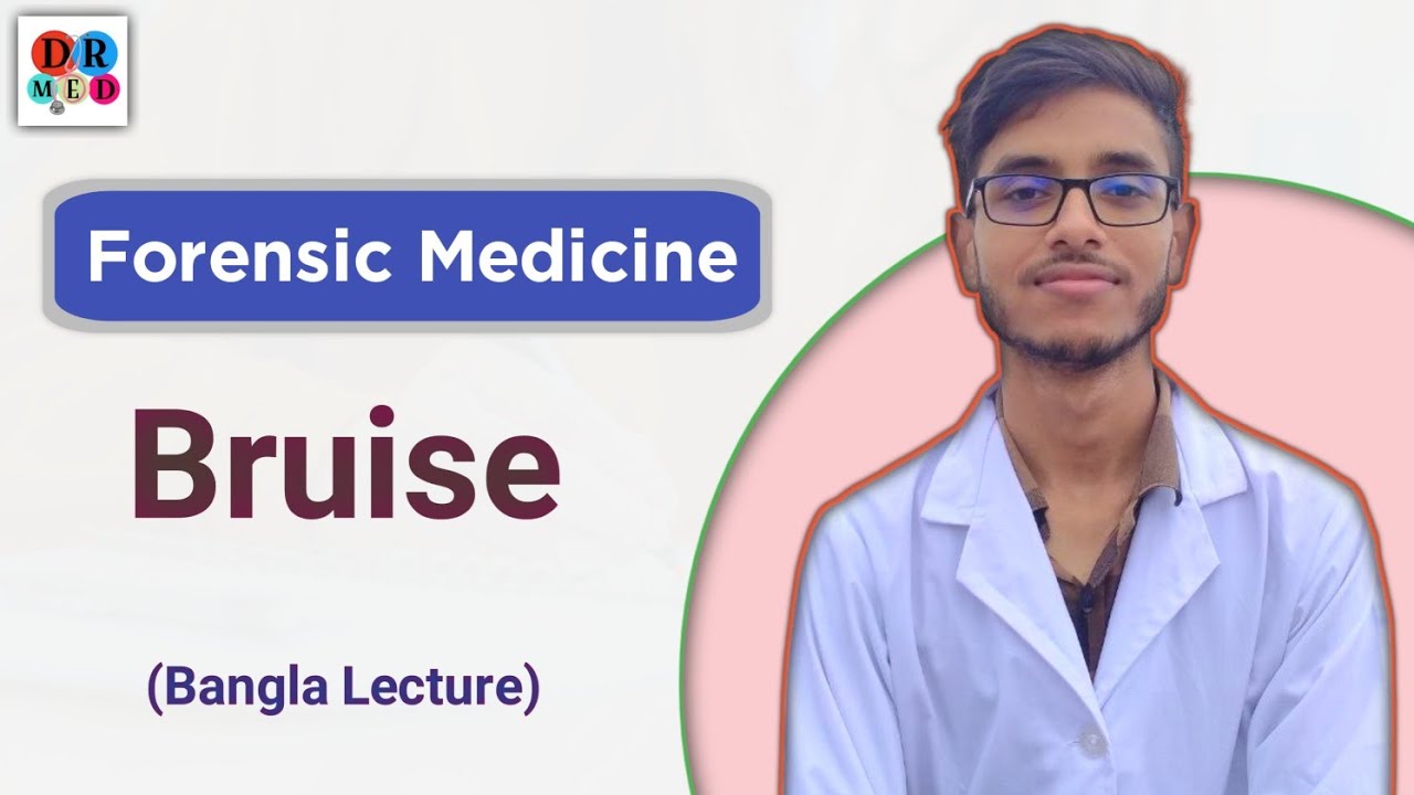 Bruise | Mechanical Injury | Weapon | Forensic medicine bangla lecture