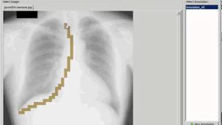 Ratsnake Annotation Tool - Radiograph