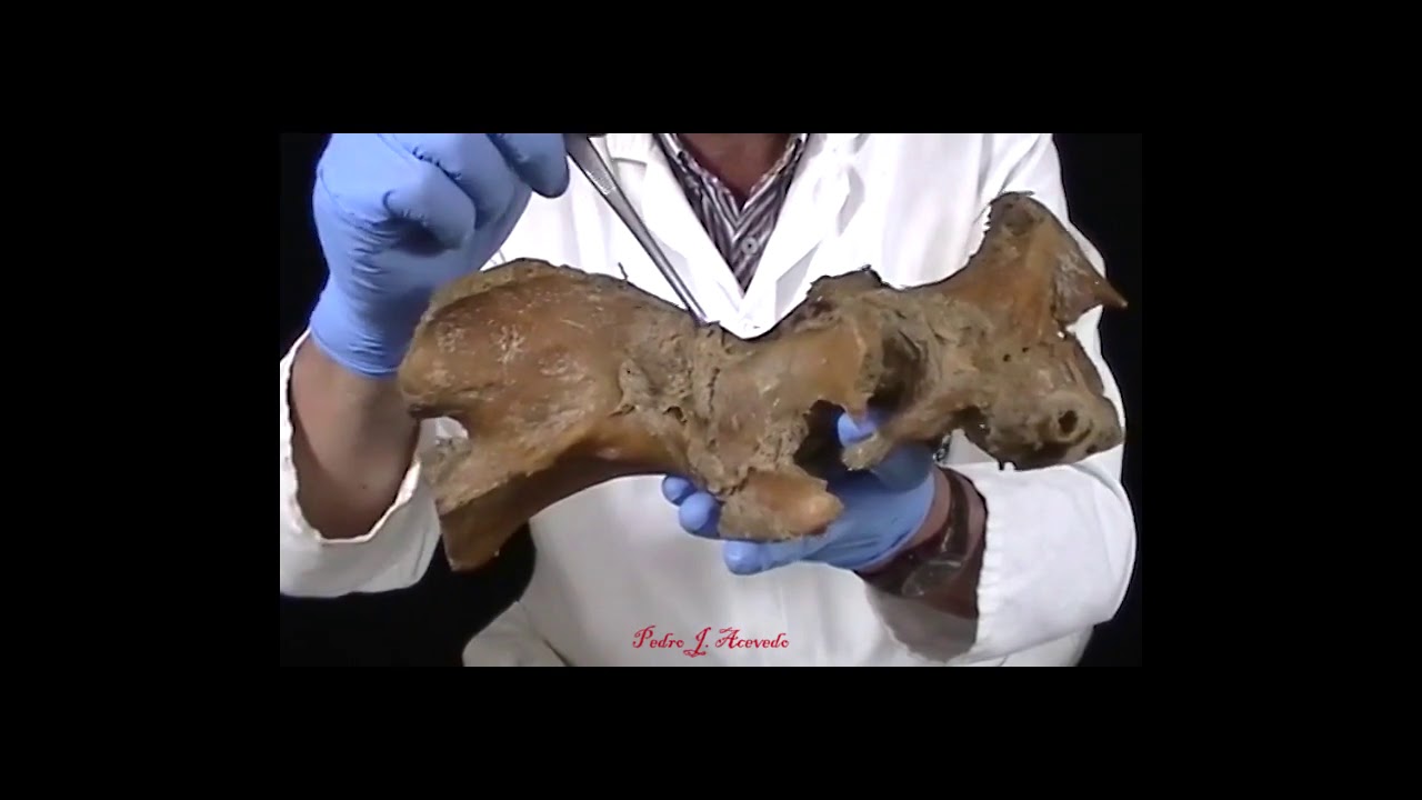 Articulación atlantoaxial del equino