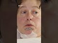 Втратила ноги через вибух FPV-дрона #shorts #shortvideo