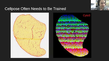 Napari meets Cellpose: Developing Workflows for Finetuning Biological Instance Segmentation Models