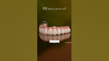Fire & Forget Implant Technology by RR Dental Labs  Immediate Loading Prosthesis Innovation