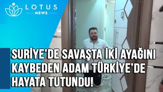 Suri̇yede Savaşta İki̇ Ayağini Kaydeben Adam, Türki̇ye De Hayata Tutundu