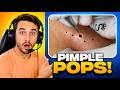 Reacting to Extreme CYST & Pimple Popping Videos (SO SATISFYING)