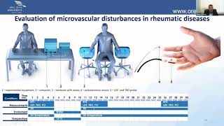 Multi-parameter optical diagnostics of microcirculatory-tissue systems: methods and technical means