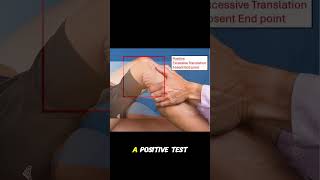 Posterior Drawer Test 🦵 #kneepain #orthopedics #sportsmedicine #physiotherapy #ATC #radiology