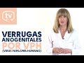 Verrugas anogenitales por el VPH (Virus Papiloma Humano)