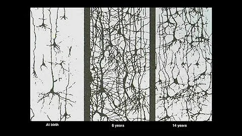 The Amazing Teen Brain