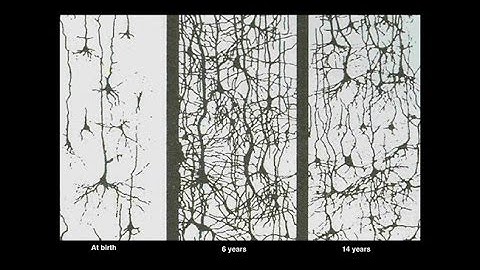 The Amazing Teen Brain