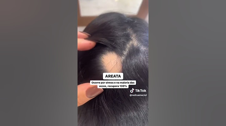 TIPOS DE QUEDA DE CABELO