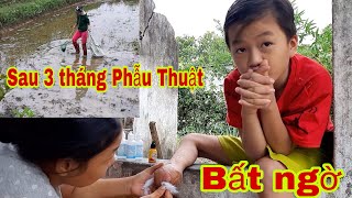 Sau 3 tháng phẫu thuật cắt nữa bàn chân của bé 9 tuổi, bất ngờ kết quả