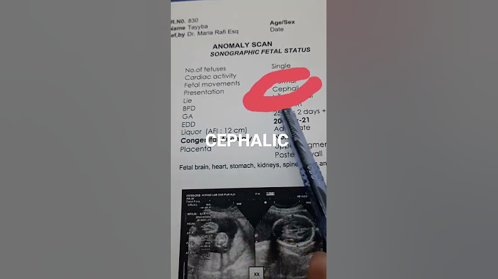 Bacha paet me sedha hae ya ni? ultrasound ki report se kesae pata chale ?