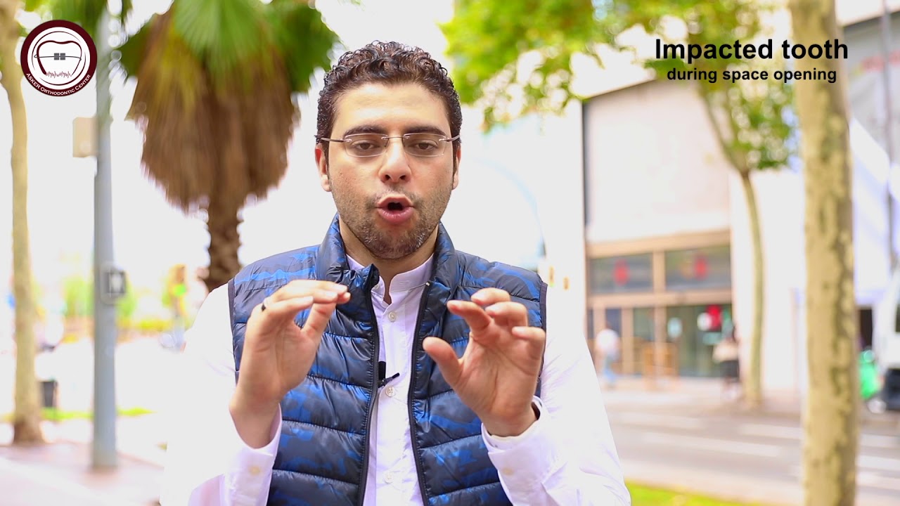 Quick orthodontic tips series Episode NO.4