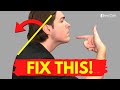 How to Fix Forward Head Posture for Good