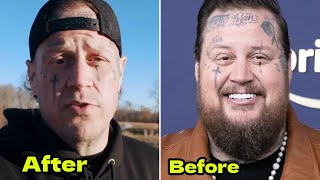 Jelly Roll SHOCKS Fans With New Look — First Time Beardless in 10 YEARS! Wealth