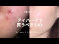【iHerb】スキンケア変えてから週一で皮膚科行ってたのに行かなくなった