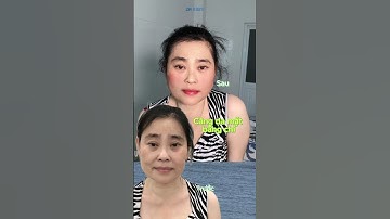 Căng da mặt bằng chỉ #shorts  #shortsvideo