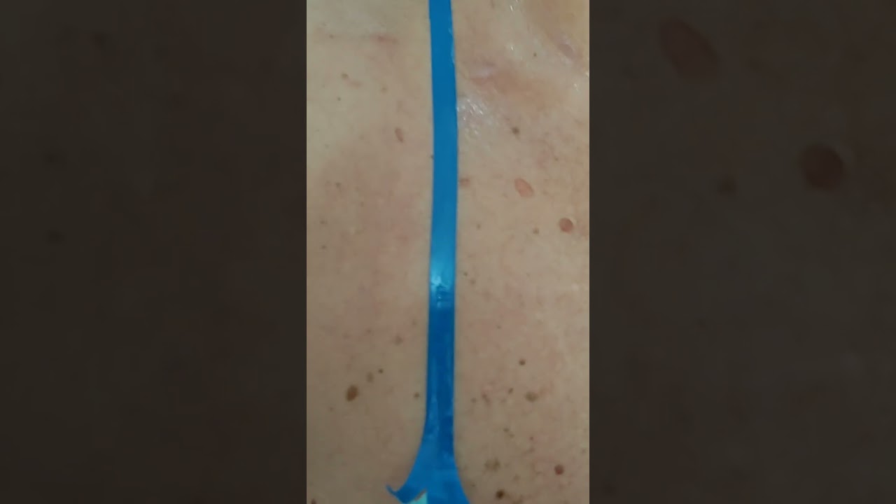 bronzeamento natural