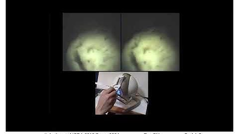 A Hybrid Actuated Robotic Prototype for Minimally Invasive Surgery