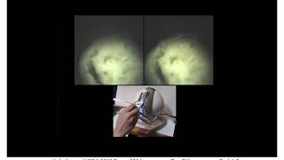 A Hybrid Actuated Robotic Prototype for Minimally Invasive Surgery