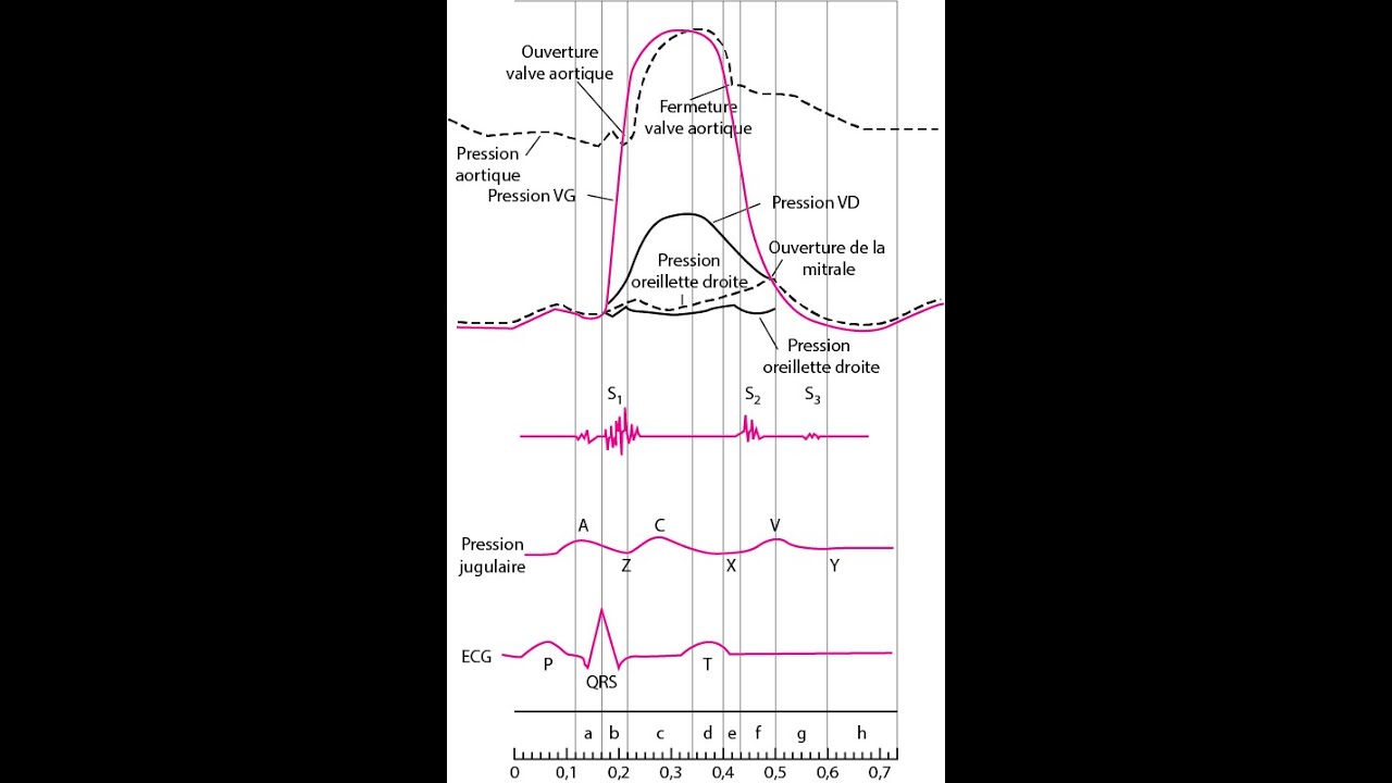 DIU CPC 2021 Cathétérisme cardiaque diagnostique par François Godart