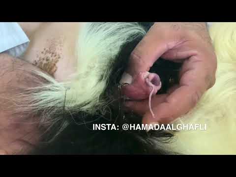 طريقة الفحص للتأكد من وجود حصر بول 