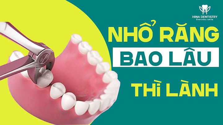 Nhổ răng khôn bao nhiêu ngày thì lành