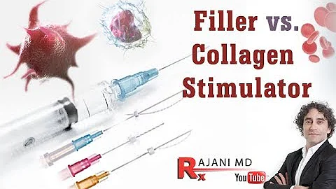 Cosa sono i filler dermici?