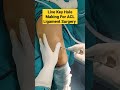 Live key hole making for acl ligament surgery  aclsurgery acl acltear mbbs surgeon doctor 