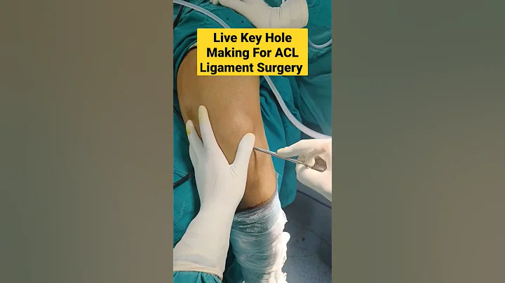 Live Key Hole Making For ACL Ligament Surgery | #aclsurgery #acl #acltear #mbbs #surgeon #doctor | - DayDayNews