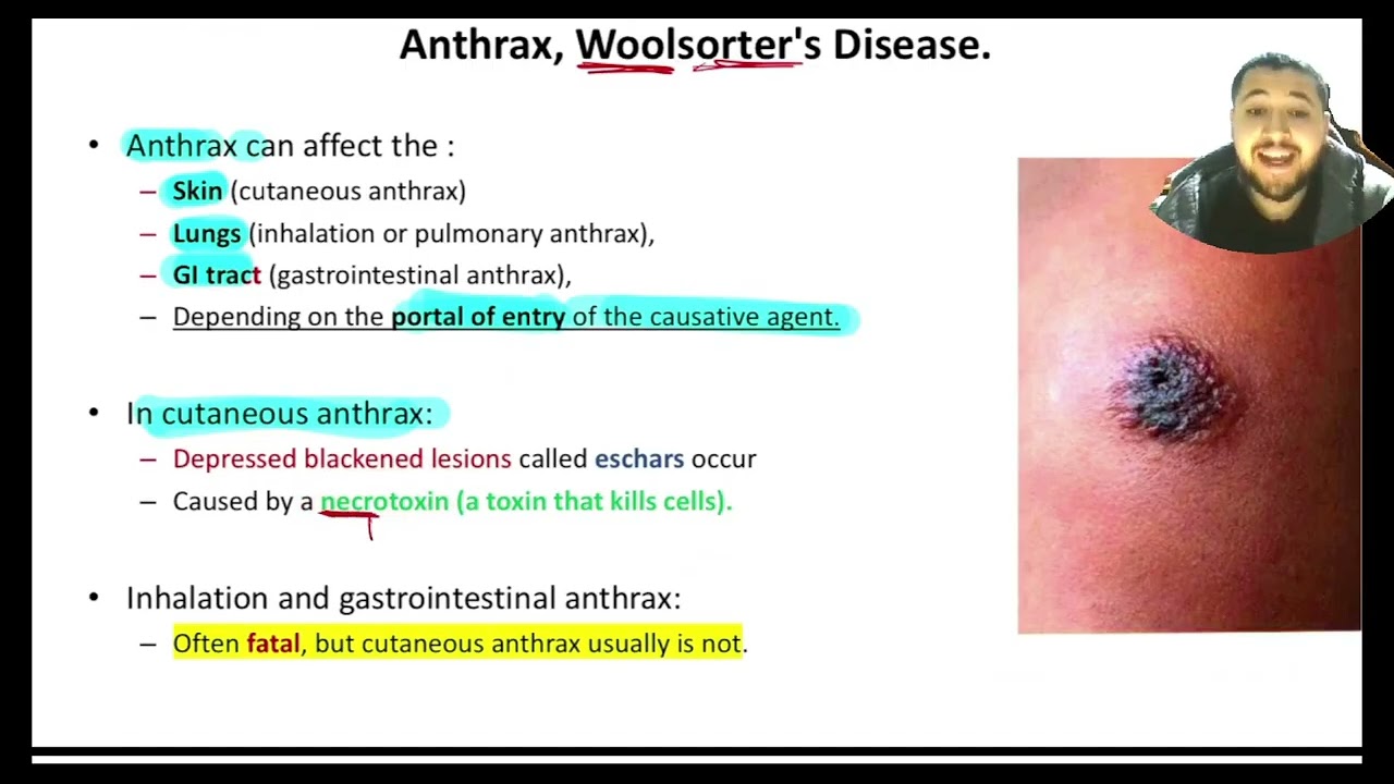 Major Viral, Bacterial, and Fungal Diseases of Humans 2