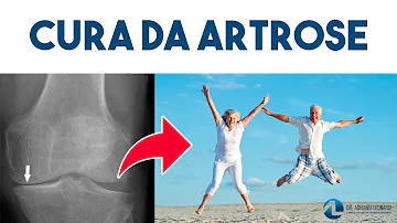 Como recuperar a cartilagem?