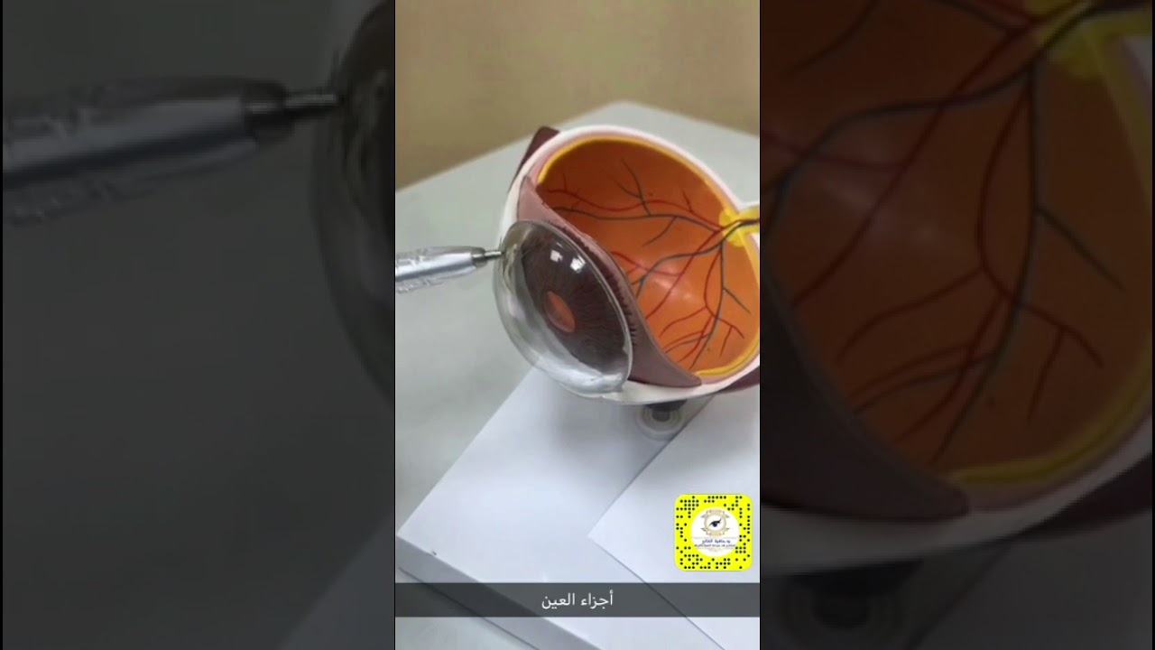 مقطع يوضح أجزاء العين بشكل مبسط .   د. حافظ الفالح