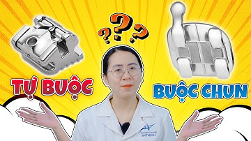 Mắc Cài Kim Loại: Mắc Cài Kim Loại Tự Buộc Hay Mắc Cài Kim Loại Thường "Xịn" Hơn? (Chấm Điểm Gắt)